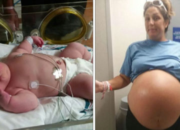 אמא ילדה תינוקת שוברת שיאים שהדהימה את הרופא שיילד אלפי תינוקות