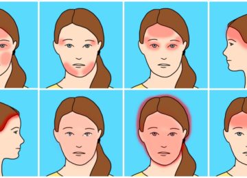 10 סוגים של כאבי ראש שכיחים והגורמים המפתיעים שלהם