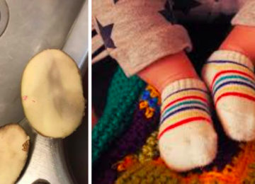 אמא שמה תפוחי אדמה בגרביים של התינוק החולה, יום למחרת היא שיתפה איך הם נראים בפייסבוק