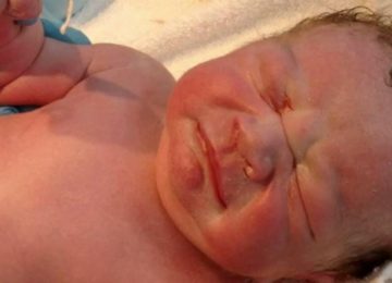 הרופאים נדהמו כשהתינוק נולד: אז הם הסתכלו מאחורי הרחם של אמא ומצאו את הבלתי ייאמן