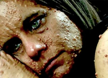 אישה עם 6000 גידולים הייתה קורבן לבריונות – המהפך עוצר הנשימה שעברה השאיר את בתה בדמעות