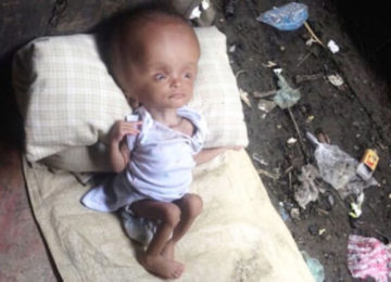 אישה גילתה תינוקת נטושה שוכבת באשפה – שנתיים לאחר מכן, היא הייתה עדה לנס