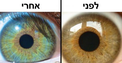 7 דברים מעניינים שיכולים לשנות את צבע העיניים שלכם