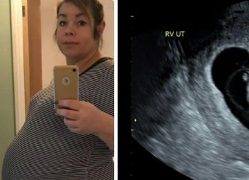 אמא לא הצליחה להיכנס להריון במשך 7 שנים, כמעט התעלפה כשהרופא הראה לה את האולטרסאונד