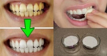 סובלים משיניים צהובות? התרופה הביתית והטבעית הזו תלבין לכם את השיניים תוך 2 דקות בלבד!