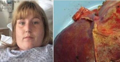אמא לפתע התעלפה במטבח – בבית החולים הרופאים בדקו את הכבד שלה וגילו את סודה האפל