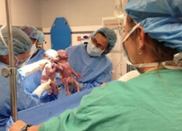 אמא טרייה ראתה את הרופאה המיילדת צורחת בחדר הלידה – הסתכלה מקרוב על התינוקות שלה, והבינה מה קרה
