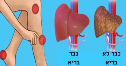 סימן האזהרה החבוי של הגוף – איך לדעת אם הכבד שלכם מלא ברעלים