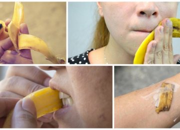 פשוט מדהים: לא תזרקו יותר את קליפות הבננה אחרי שתקראו את זה…