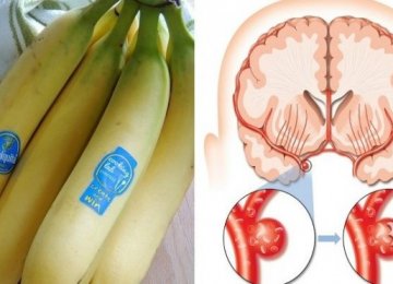 אכלו 3 בננות ביום, וזה מה שיקרה למוח, ללב ולהיקף המותניים שלכם!