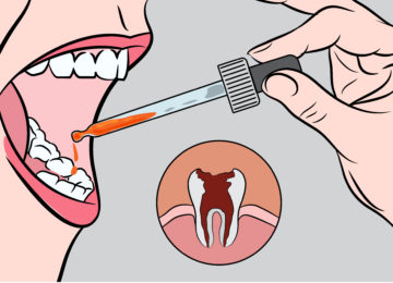 שימו כמה טיפות של התרופה הטבעית הזו בפה, והיפטרו בשניות מכאבי השיניים