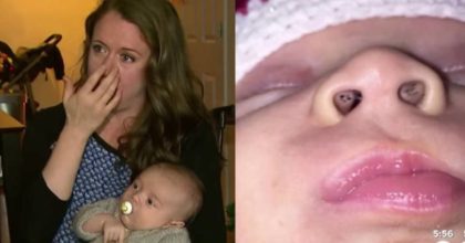 אמא הבחינה בנקודות שחורות מוזרות בתוך האף של בנה התינוק – ואז גילתה את האמת המפחידה